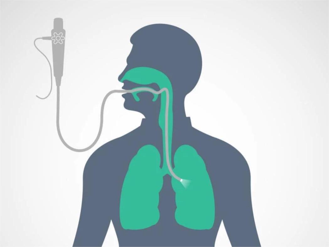 电子支气管镜厂家给您介绍：吸痰操作技巧
